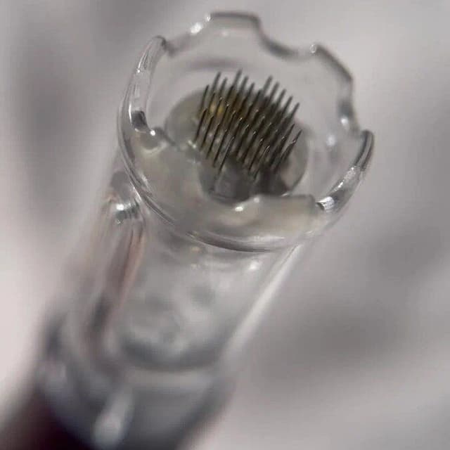 Micro-needling series at Shell Esthetics in Wilmington, NC